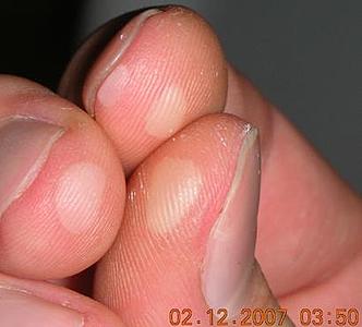 click for enlarge 410 X 370  15.8 Kb picture